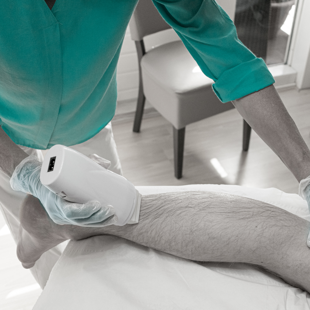 waxen van benen hars op de huid rollen tijdens behandeling in Den Haag